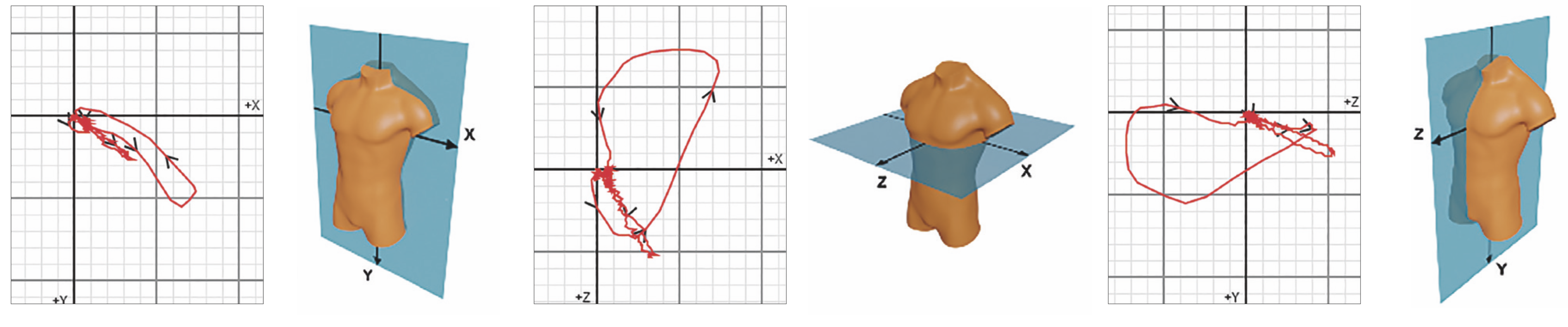 vector loops of ECGmax